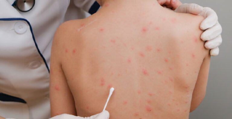 Pediatric Skin Disease Treatment